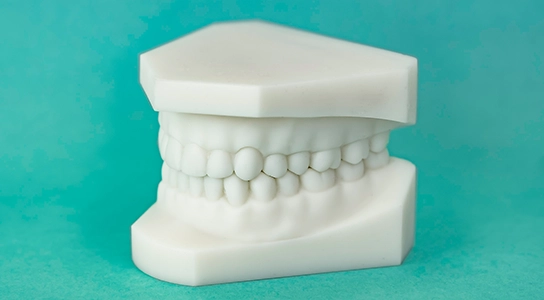 SLA 3D printing and vacuum casting in Kochi healthcare for surgical guides and dental models